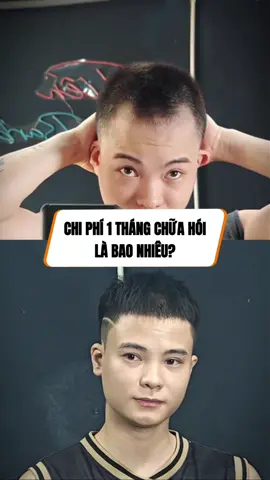 Chi phí 1 tháng#tienbarber #trihoidau #minoxidil 