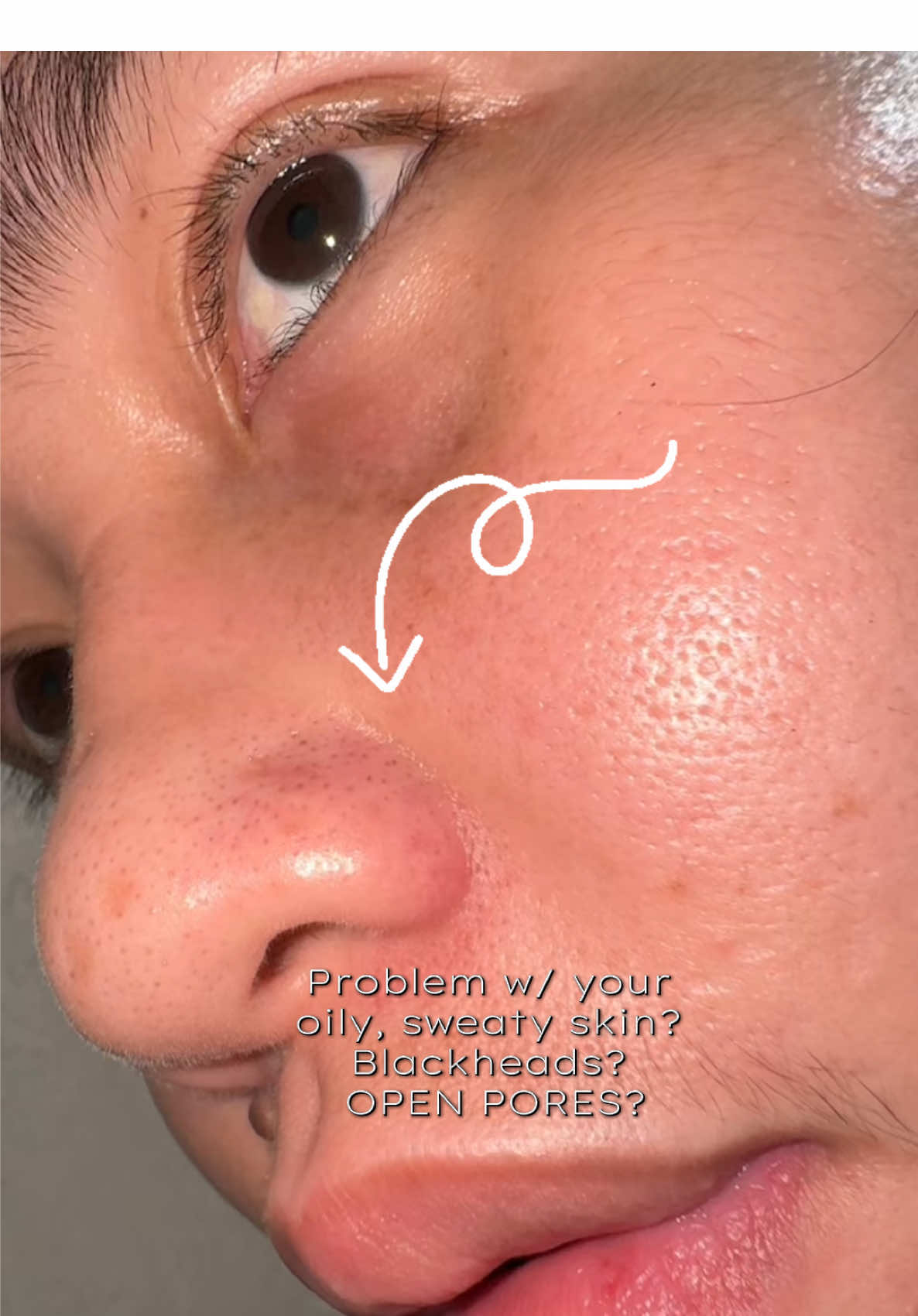 #klued #kluedsalicylicacid #kluedgentlecleanser #gentlecleansers #salicylicacid 