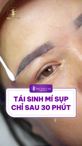 Tái sinh mí sụp chỉ sau 30 phút! 😱 #nangcungchanmay #nangcung #phuhuymi #thammy #xuhuong 
