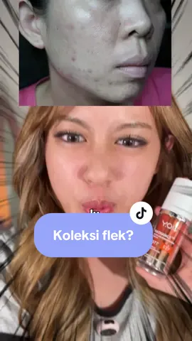 kalo udh banyak bekas kek gini pasti bawaannya pasrah 🥲 #YOURadianceSeries #YOUSkincare #YOUbeauty #YOURadianceSeries 