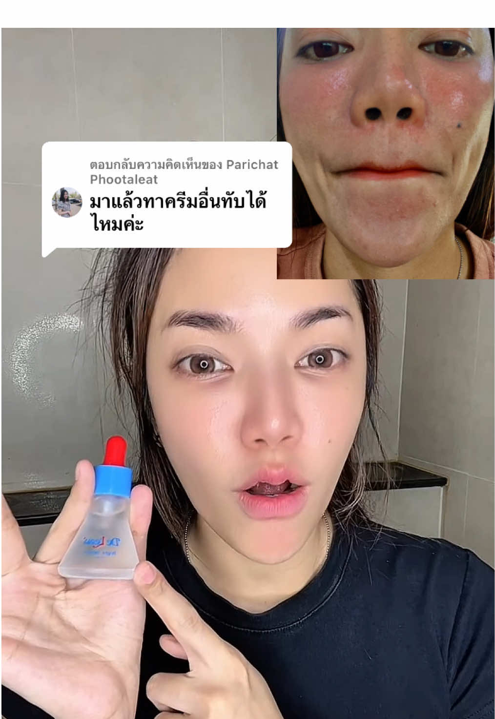 ตอบกลับ @Parichat Phootaleat #เซรั่ม #เซรั่มจุกแดง#เดอโลไบร์ทเซรั่ม #ซื้อด้วยคูปอง#เซรั่มบํารุงผิวหน้า 