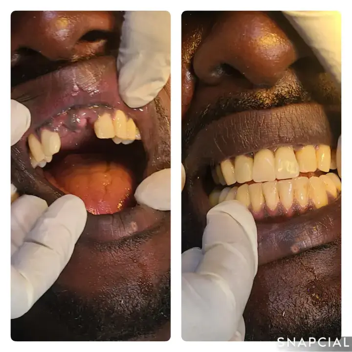 Contact me for Quality Dental services @ 0759005660