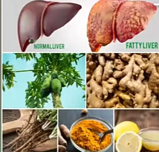 HELP TO CURE FATTY LEVER