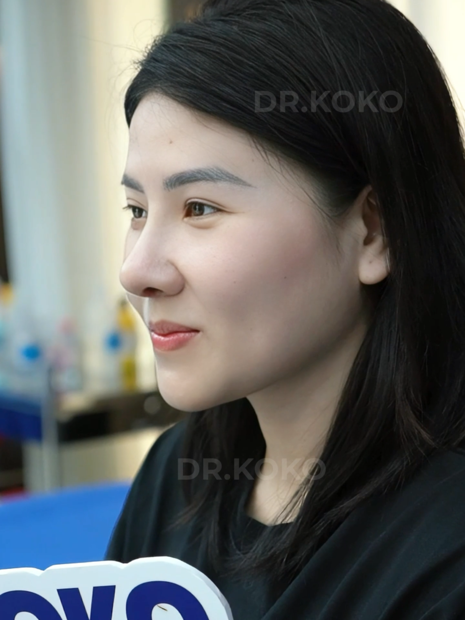 Hidung lebih indah, wajah tampak harmonis ✨ Rhinoplasty membuat penampilan semakin percaya diri #operasihidungvietnam #vietnamrhinoplasty #sedotlemak #KlinikKecantikan #bodycantik #KOKO #drkoko #Rhinoplasty #ConfidentEveryDay #positiveexperiencesabroad #KokoCare #perbaikanhidung #hidungcantik #operasihidungmurah #koko #NaturalBeauty #pinggangramping