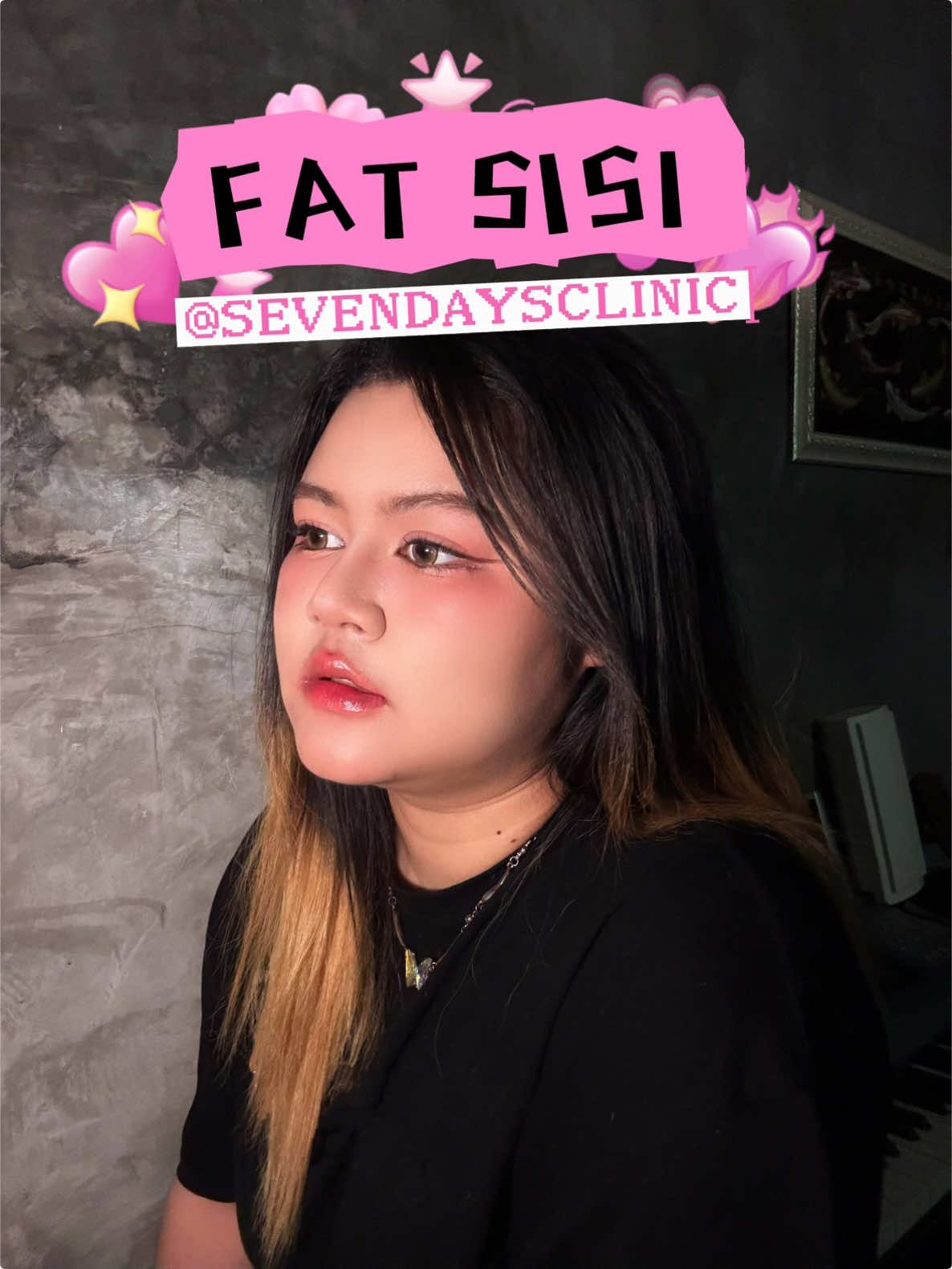 แก้มกลมก็เก็บได้ด้วย โปรแกรมแฟต sisi 😳💖 📍@sevendaysclinic 🧏🏻‍♀️🤏🏻 #sevendaysclinic #sevendaysclinicreview #chubbygirl #แฟต #หัตถการ 