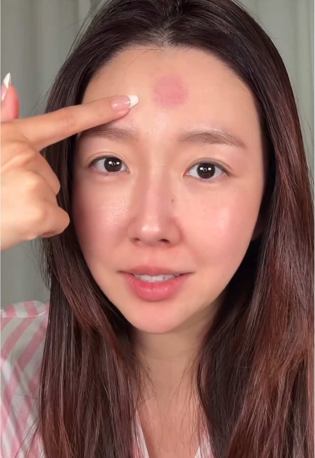 SPILL DRAMA LUKA DI MUKA 😢 SAMPAI NGGA PENGEN KELUAR RUMAH!