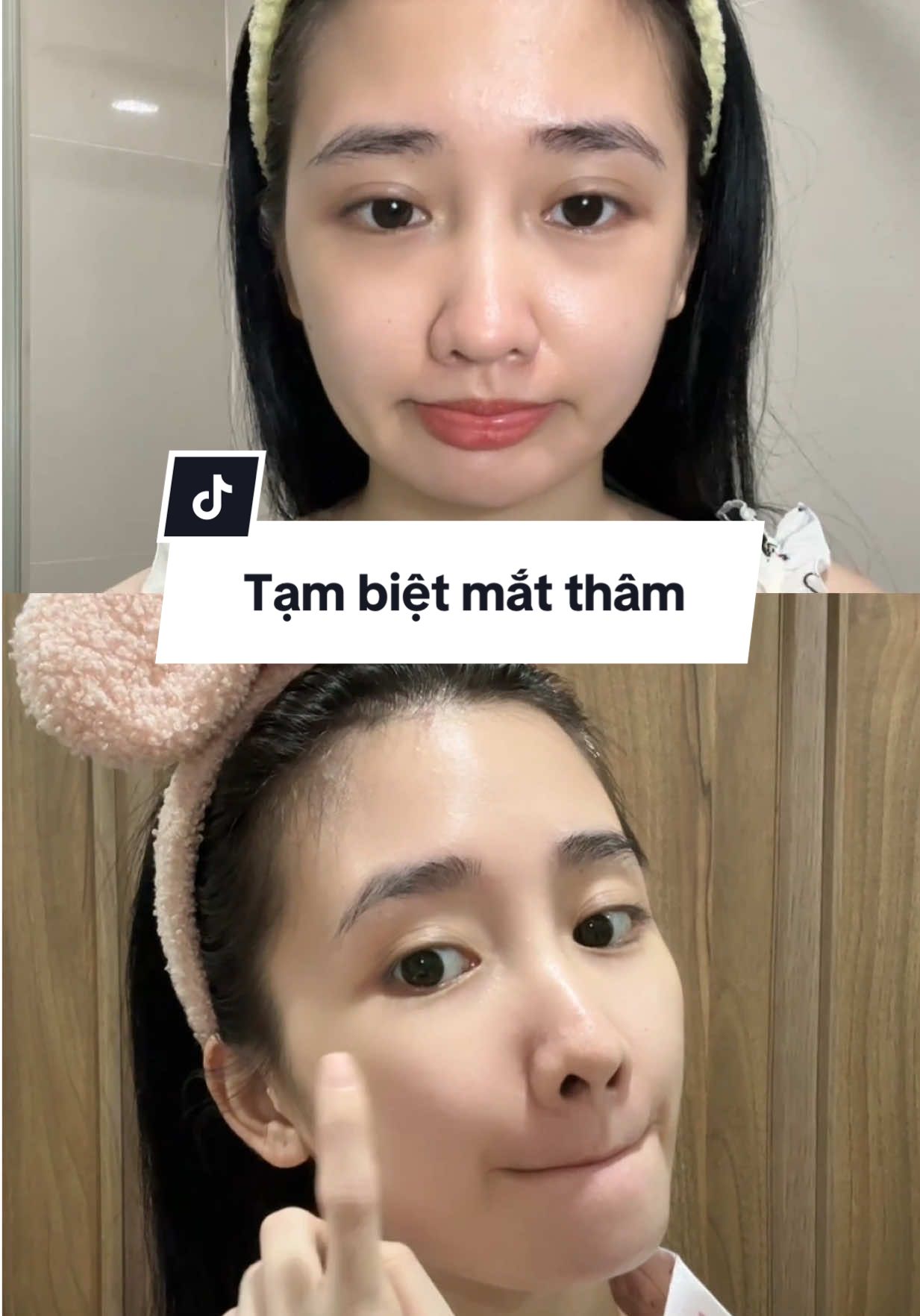 Bye mắt thâm 🌚🫷🏻 #Lanbena #chamsocda #Lanbenamatnamat #giamtham #skincare 