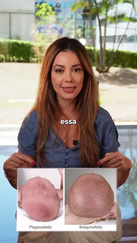 Já reparou no formato da cabecinha do seu bebê? Algumas mudanças de posição ajudam a evitar que ela fique achatada. Salve para lembrar depois e compartilhe com quem também precisa saber! #Pediatria #DesenvolvimentoInfantil #MaternidadeReal #tummytime #bebes 