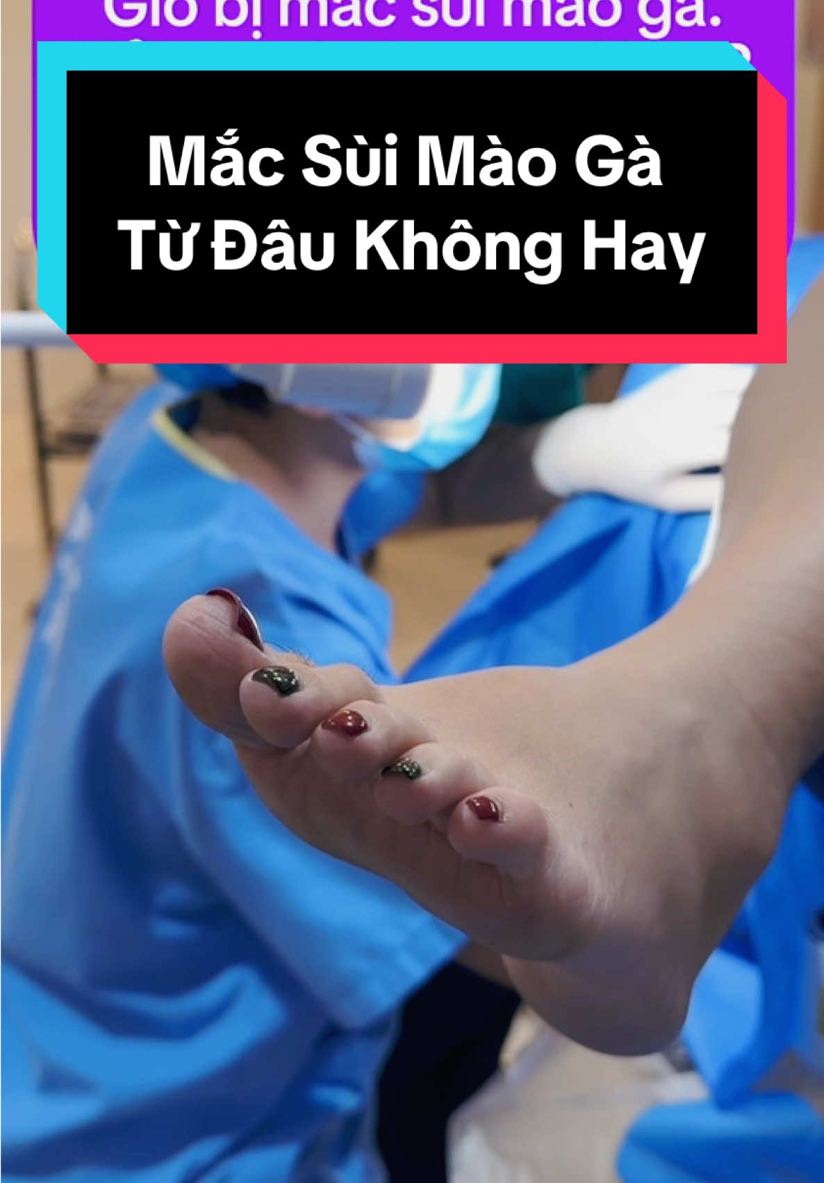 Là con gái thật khổ 😩😩 Mắc sùi mào gà từ đâu không hay, vk ck thì căng thẳng 🫣 #suimaoga #nhachaymoingay #bacsisac #hpvvirus 