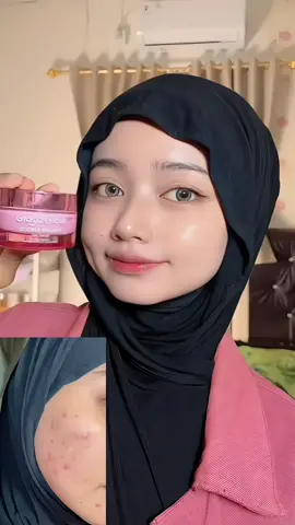 #g2g #glad2glow #daycream #daycreamg2g #acnefighter 