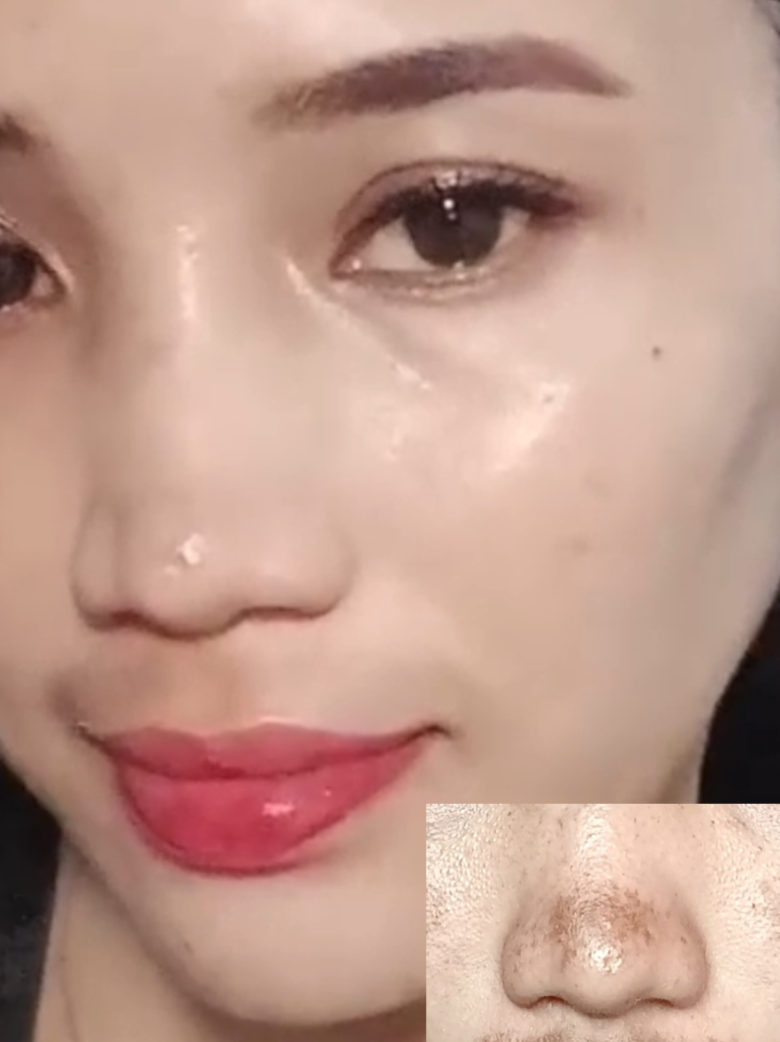 Kenapa GK dari dulu😭Terharu bangett🥹padahal dulu udah capek bangett Gonta ganti skincare gkada hasil🥹😭😭#pejuangflekhitam😭😭😭 #pejuangflekhitam #melasma #krimflek #jsskincare 