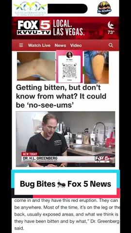 No See ‘ems Fox 5 News 🎥 🍿 with Dr. H.L. Greenberg • Thank you @FOX5Vegas & @VictoriaSaha for interviewing me & @maneoba @lvderm @dermbros about the, 