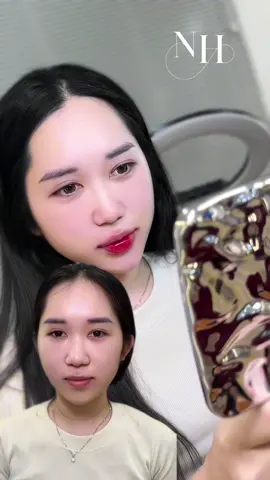 𝐍𝐡𝐞̣ 𝐧𝐡𝐚̀𝐧𝐠 mỗi vùng thêm 1 xíu thui là xinh thế này này… #filler #botox #fillerbotox #xuhuong #fillerbotoxhot2025 