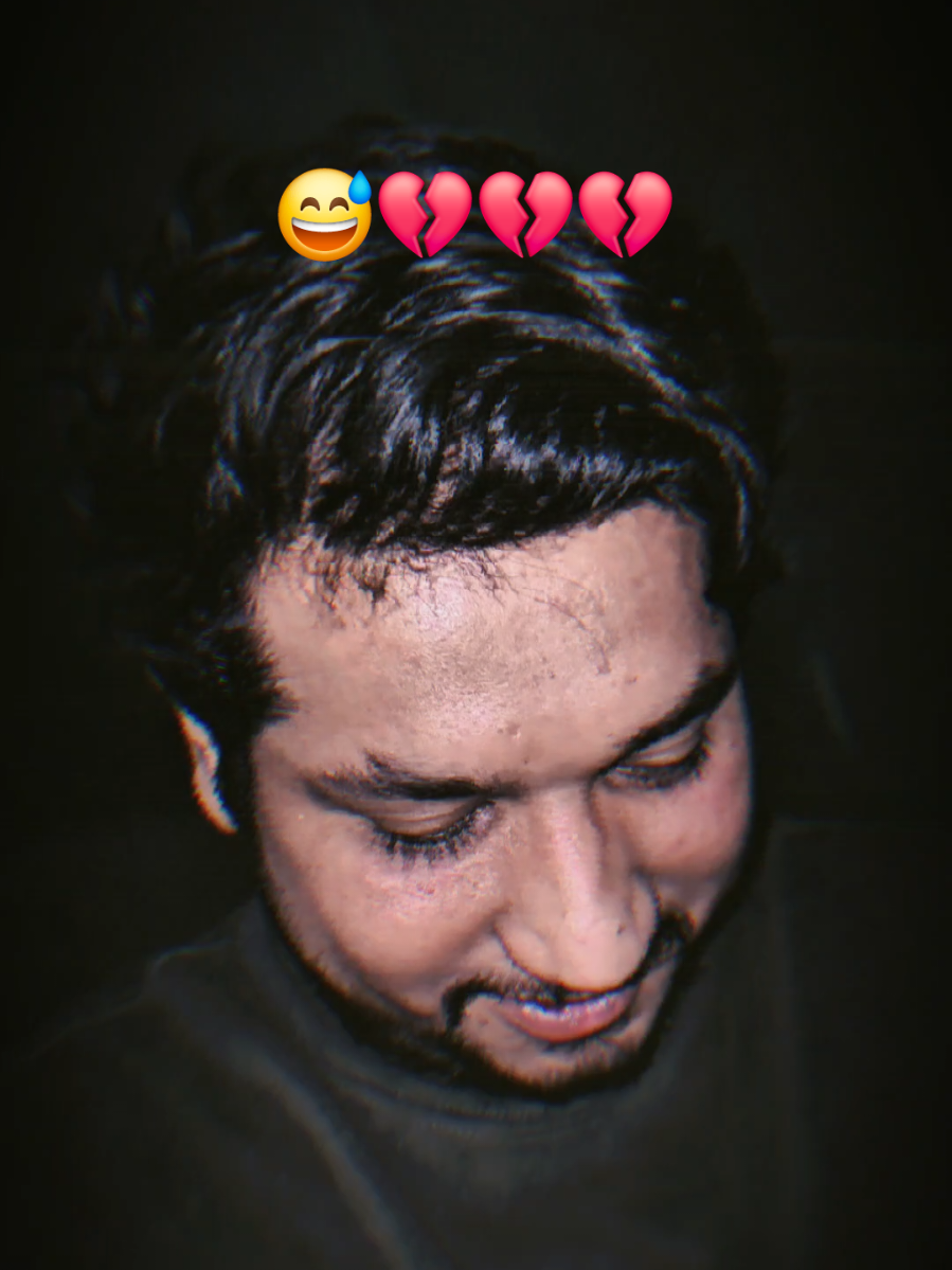 নতুন করে আর কি ক্ষতি করবি  😅💔💔💔#foryou #fpyシ #tiktok #trending #rolex 