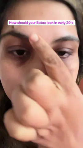 How your Botox look in early 20’s @SKIN1004 US 	#GoViralWithSKIN1004Challenge #SKIN1004White #skin1004 #centella #kbeauty 