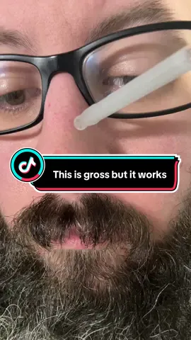 This peel shot duo is actually amazing and it works! @Drmelaxin  #tiktokrestock #drmelaxinpeelshot #drmelaxin #acneskincare #acneproneskin 