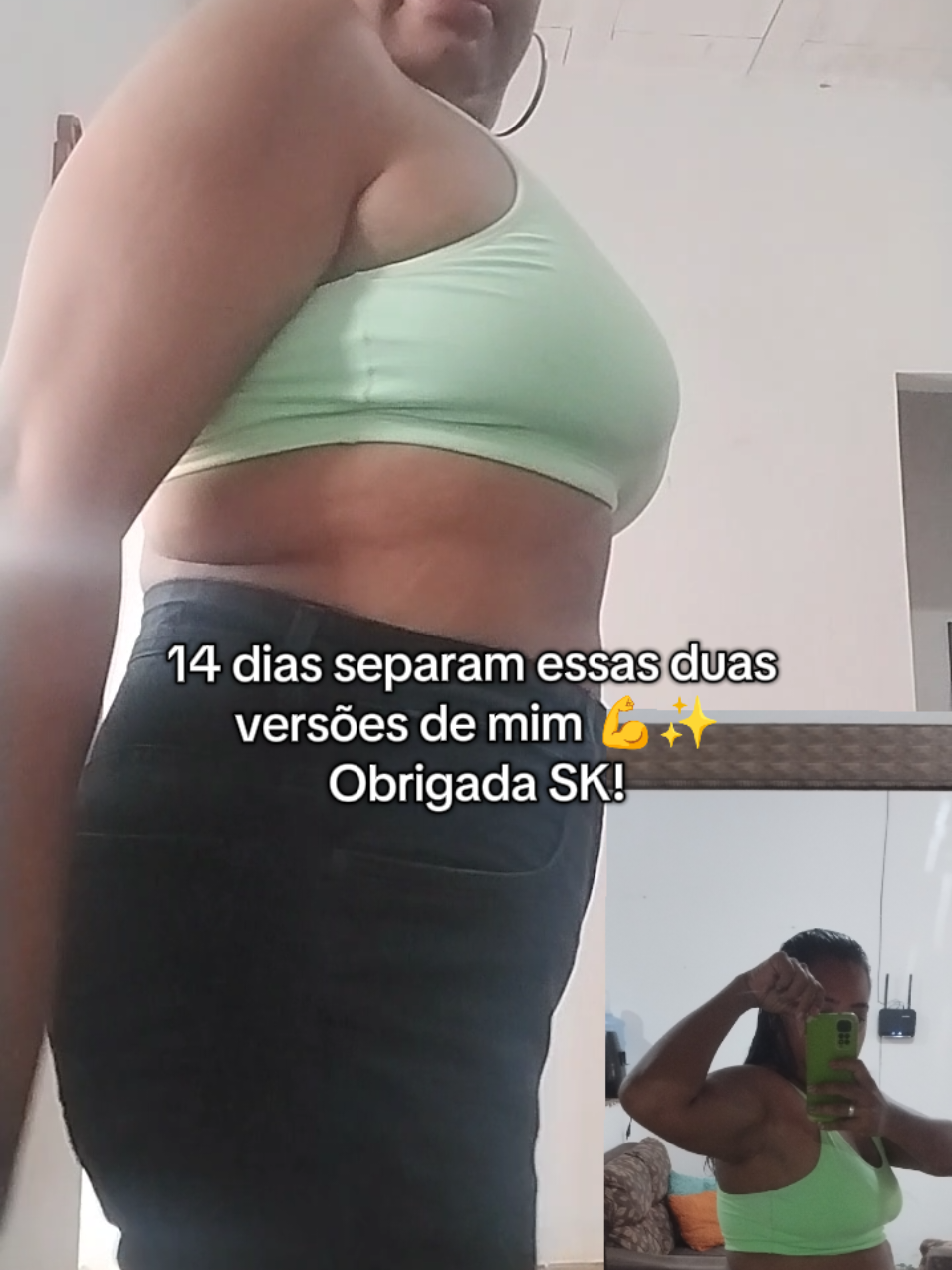 Olhar o antes e depois lado a lado é emocionante 🥹 Em tão pouco tempo, já sinto a autoestima de volta graças ao SK 💕 