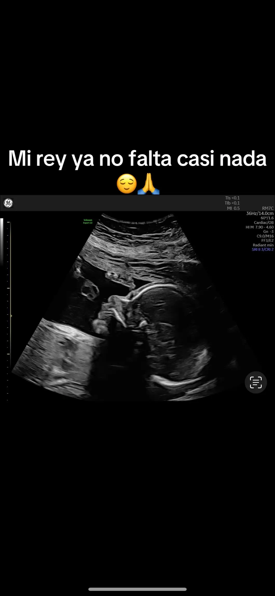 #fypシ #parati #gabrielarias13 