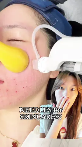 avoid the painful treatments & check out @Dr.nineteen’s ReDRN Exosome Ampoule on Amazon for glass skin ✨ #greenscreenvideo #drnineteen #BiomePDRN #clinicallyproven #AtHomeClinic 