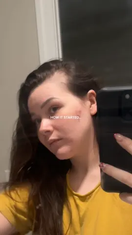 And that’s on consistency✨😮‍💨 @RootLabs  . . #rootlabs #bebodywise 