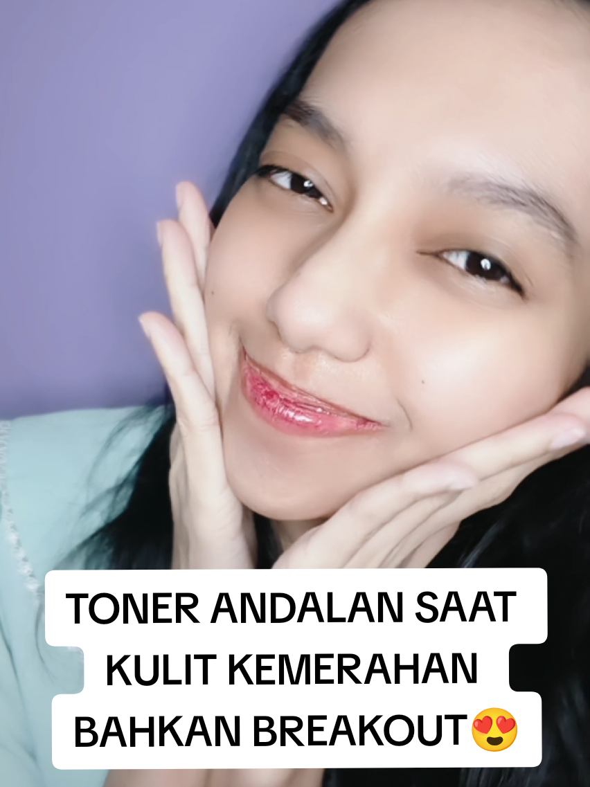 kulit lagi kemerahan? gaperlu khawatir langsung teknik CSM aja dengan tonernya dari @wardahofficial yang bantu meredakan atau mengurang kulit kemerahan dan iritasi bahkan jerawat juga💖  #FreshAndFlawless #WardahFaceTonerBaru #WardahFaceTonerViral #WardahTonerBestSeller #WardahFaceTonerRevamp 