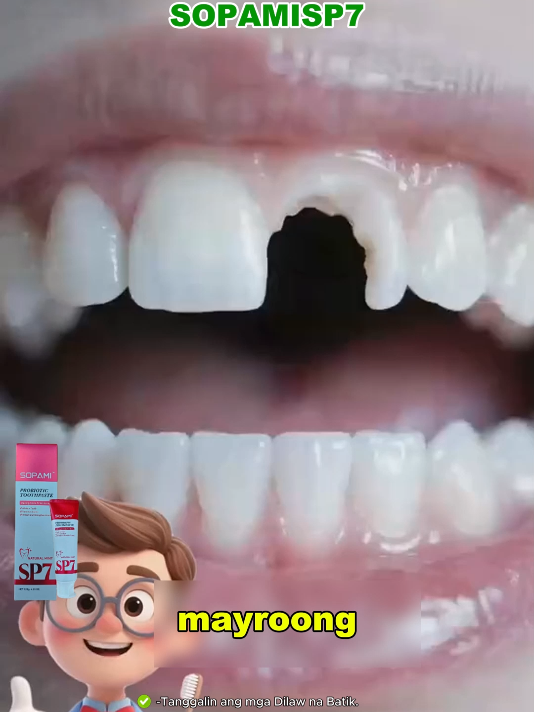 Ang before-and-after gamit ang SP7—nakakagulat ang resulta!#fyppppppppppppppppppppppp #SP7 #smilescore #viraltiktok #fypage