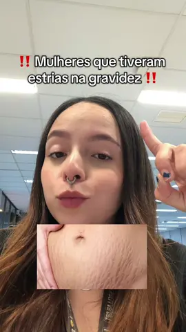 Você vai ver elas desaparecerem 🤭 #estrias #flacidez #celulite #cellufix #fypシ゚ 