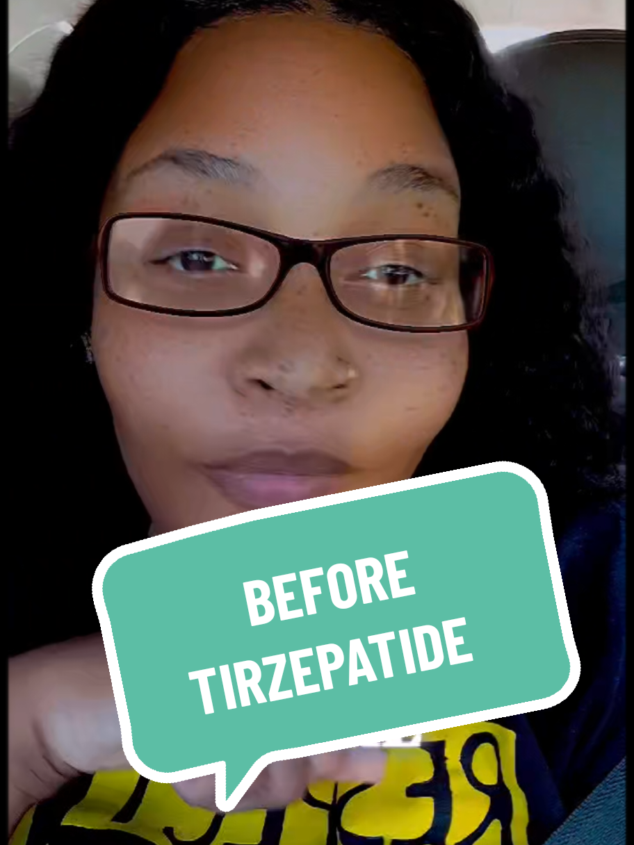 #WEIGHTLOSSJOUNEY #glp1community #GLP1 #TIRZEPATIDE #tirzepatidejourney 