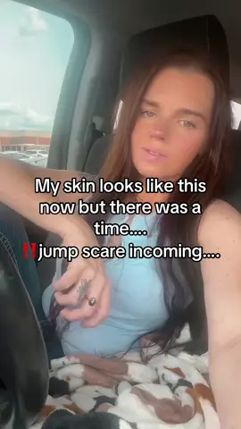 #greenscreen #greenscreenvideo #medicube #clearskin #koreanskincare 