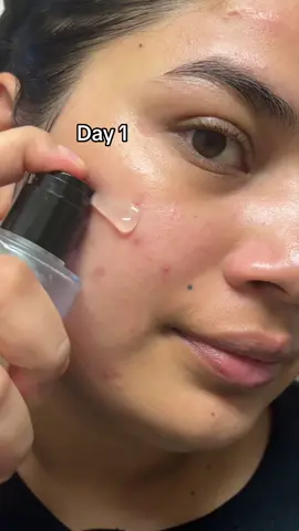 Obsession with Advanced Snail 96 Mucin Power ✅✨@COSRX Official  Essence is REALL #COSRX #COSRXDermSkincare #KoreanGlidingTexture #SkinBarrier #200hourmoisturizing 