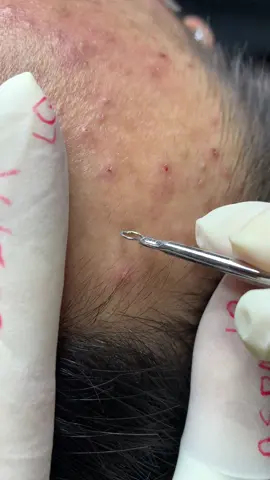 Chị oi chị #chamsocdaseo#chamsocda#chamsocdamun#chamsocdanam#tanbinh       