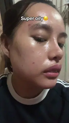 anti acne face wash #fyp #youbeautyph #facialwash #youacneplus 