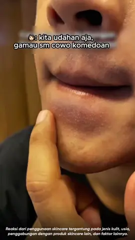 🍀Ih kamu yah yang masih mencetin komedo mulu?! STOP KACK🖐🏻 Coba nih Madagascar Centella Light Cleansing Oil yang bisa membersihkan wajah hingga ke pori-pori✨ Yuk checkout di TikTok Live~ #G2G #CleansingOil #blackhead #komedo #wajahbersih #cleansing #skincarereview #centella #makeupremover 