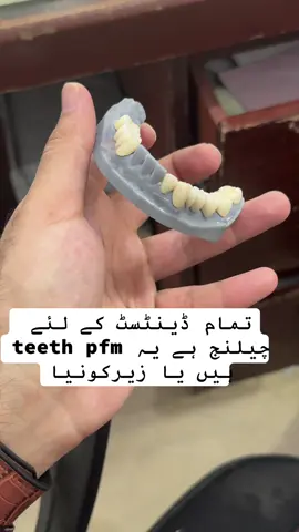 #unfreezemyacount #samidental_and_aesthatic #samidentallab #samidentallab #samidentallab 