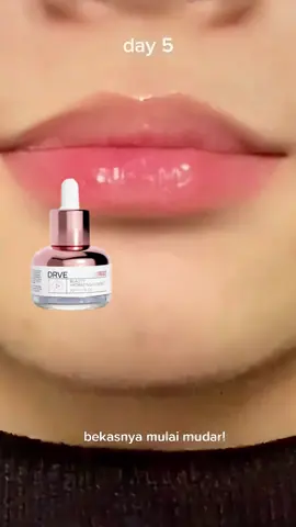 kulit ku sekarang makin terlihat segar dan cerah🥰🥰#serumretinoldrve #skincareehacks #kulitglowing #skincareviral #kulitlembap #bumilbusuiaman🥰 #glassskinroutine #foryourbeauty #cantikalami #DailyRoutine #daycream #skincareroutin #bpom✅ #kulitsehat #skincaredrve #serumretinol #fypppp #viralllllll #healthyskin #virall