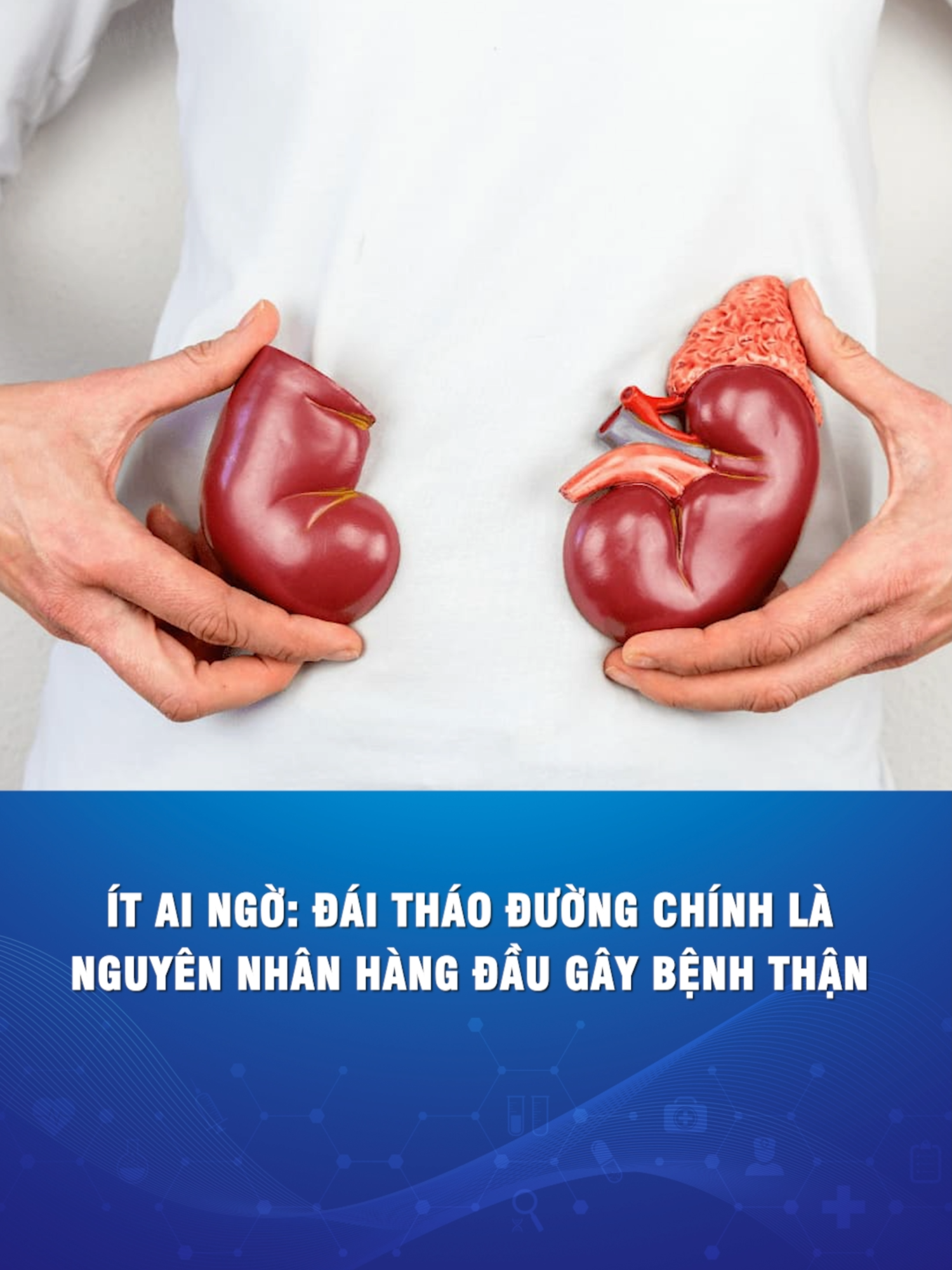 Đái tháo đường là nguyên nhân hàng đầu gây bệnh suy thận #benhvientamanh #TiktokForHealth #suythan #songkhoe247 #daithaoduong #tieuduong