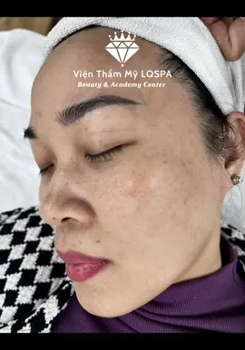 Nhanh đẹp #lấynhanmunbangtay#chamsocdamun#chamsocdaseo#chamsocdanam#tanbinh    &Acedemy