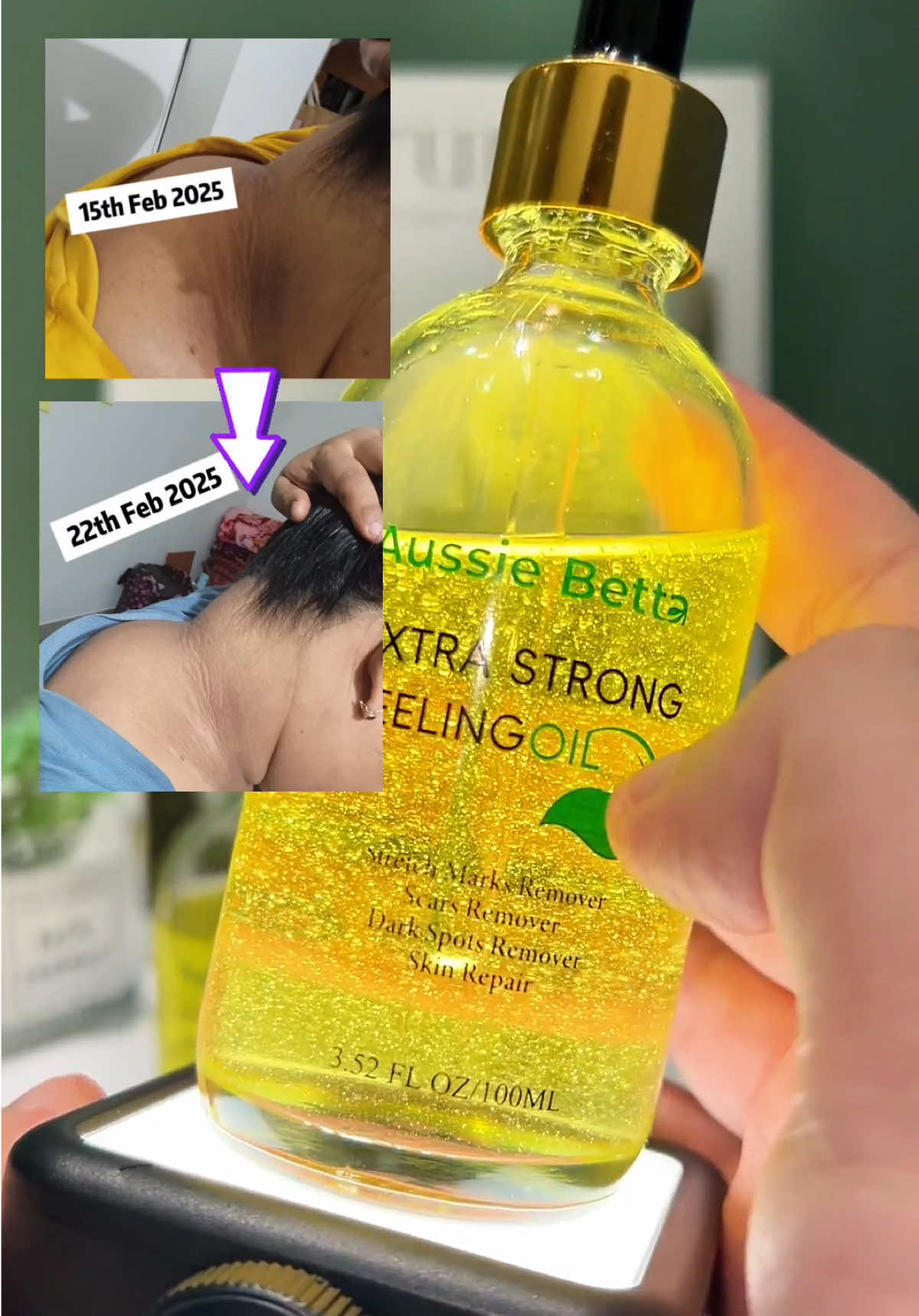 From rough to radiant ✨ Just peel it off! Watch your old skin shed & new glow appear 😍 #FallFreshness #blackskincare #exfoliate #yourskinreborn #fyp 