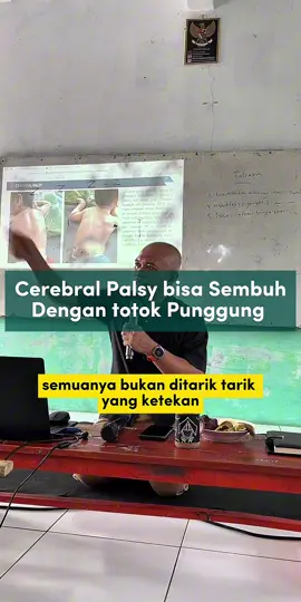 Alhamdulillah Medis yang bilang Cerebal palsy tidak bisa disembuhkan, dengan Totok Punggung Cerebral palsy bisa membantu penyembuhan Bagi yang ingin datang langsung ke klinik silahkan kesini 👇 Graha Sehat Totok Punggung UAR 082310754773 Jl taman harapan baru timur lv blok p3 no.09 kel pejuang,kec.medansatria-kota bekasi 📍 Google Maps Totok punggung ust Abdurrahman Taman Harapan Baru (THB) https://maps.app.goo.gl/feditrEHfvvtuTLS9 📍 Google Maps Totok Punggung ust Abdurrahman Jatiluhur Jatiasih  https://maps.app.goo.gl/ebcrstUzRwLDewA98?g_st=ac Jl. H Dehir gg lancim no.125 RT/RW 008/002 Jatiluhur kec. Jatiasih kota Bekasi 📍Google Maps Totok Punggung ust Abdurrahman Huma Akasia https://maps.app.goo.gl/WPk9kgoPn2e85Xik9?g_st=ac Jl. Komp. Huma akasia, RT. 003/006 Jatiwarna kec. Pd melati kota bekasi Buka setiap hari Pukul 08.00 - 16.00 WIB Dengan tarif terapi 120.000 / sekali terapi  Durasi terapi 45 - 60 menit  Tidak ada Pendaftaran Online, Pendaftaran Langsung di klinik ☺️ #UAR #totokpunggung #sehatalami #sehattanpaobat #cerebralpalsy 