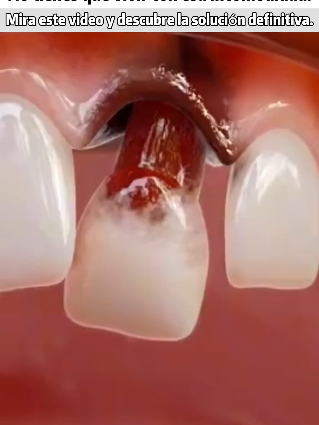 Amigos, les tengo noticias importantes sobre el blanqueamiento dental. Pasta de dientes blanqueadora Elimina los dientes amarillos y el sarro.