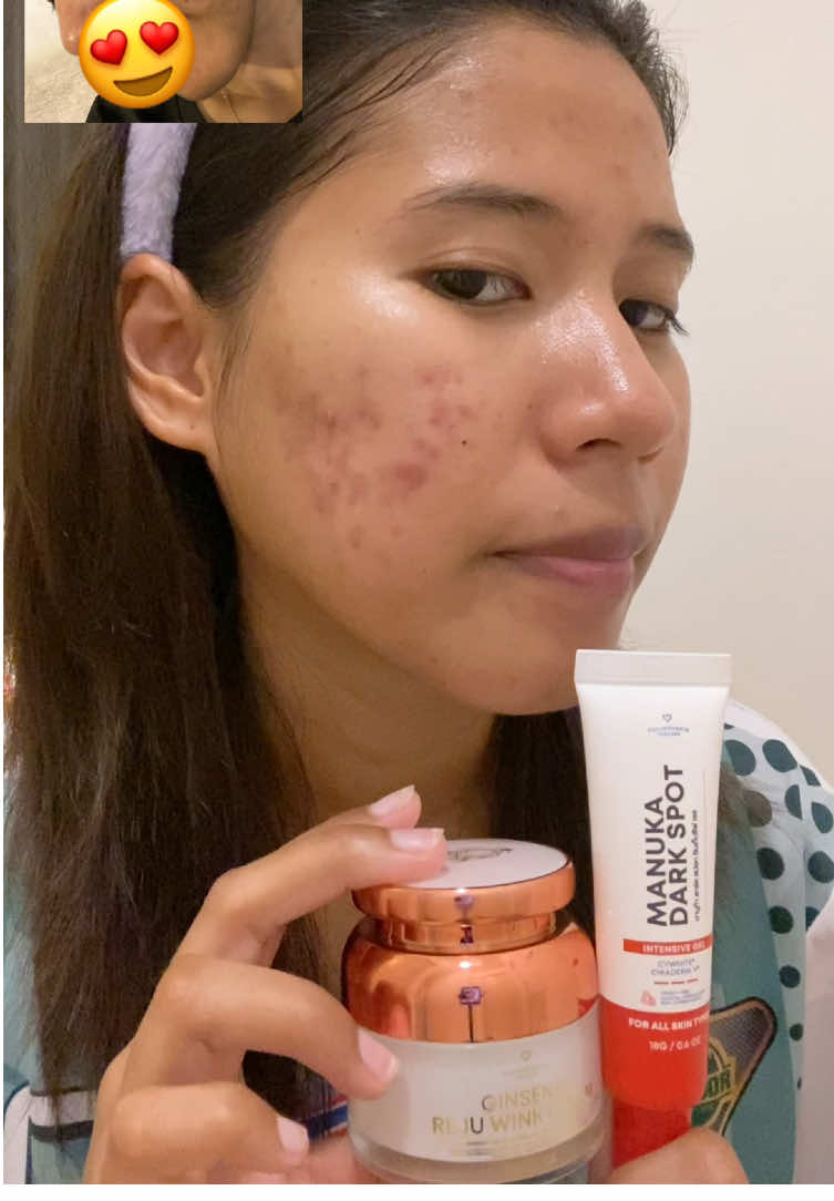 กราบเจ้าของแบรนด์🥹 #founderskin #ฟาวเดอร์สกิน #เจลมานูก้าฟาวเดอร์ #โสมรีจูวิงค์ #เจลลดรอยสิว 