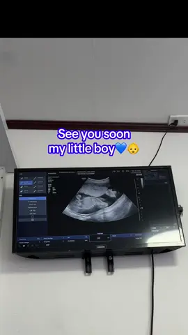 See you soon my little boy#mommy #preggymommy #ultrasound #babies 