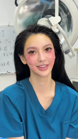 ✨ At 32, even as a professional model, I started noticing signs of fatigue — sagging contours, deep lines, and less confidence on camera. Meeting Dr. Xie changed everything. With the 9D Facelift, my face was lifted, refined, and full of youthful glow again. 💎 Now I’m not just posing for the camera — I own it. #9DFacelift #ModelLife #FacialRejuvenation #YouthfulGlow #BeautyTransformation   