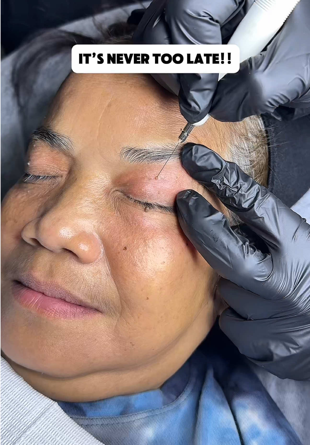 hindi pa huli ang lahat mga momshiesss #pampertime #motherdear #medskin #medskinprimeclinic 