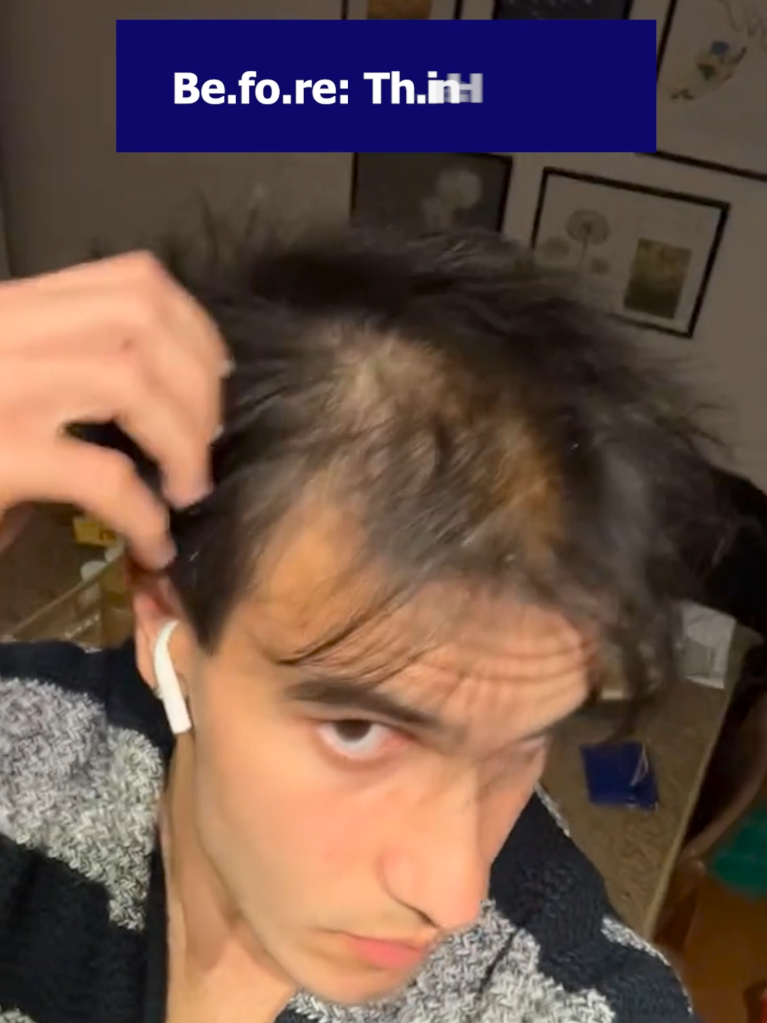 The secret to have lo.ng th.ick h.air#fegplus