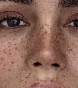 Freckles look so beautiful😻#fyypppppppppppppppppp #varialvideo #fyp #pinterest 