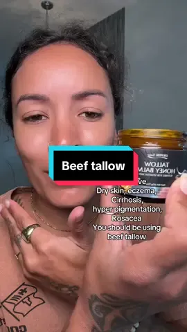 I wish I would’ve known about beef tallow a long time ago! I swear by this stuff! #beeftallowskincare #beeftallowmoisturizer #rosaceaskincare #eczemarelief 