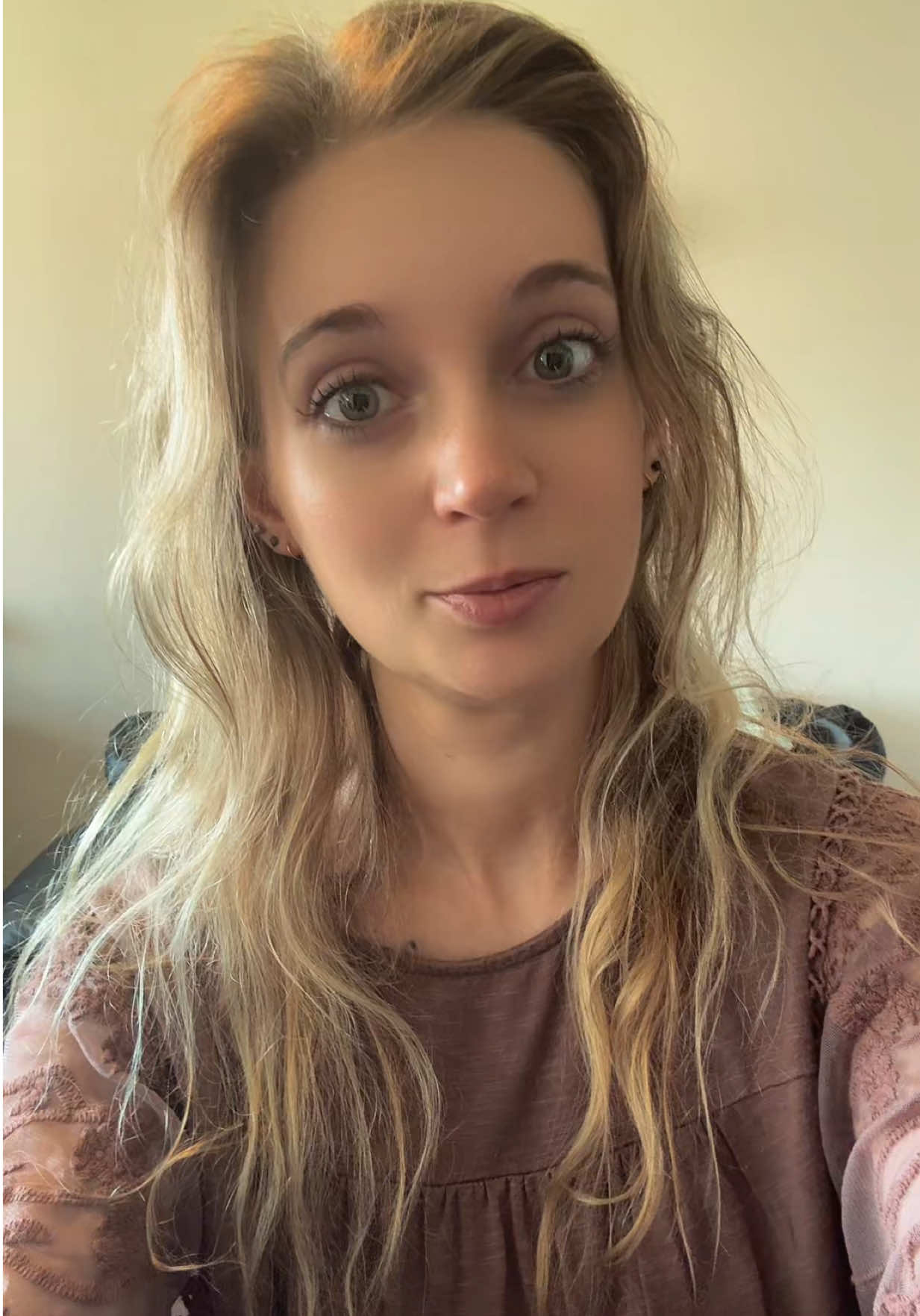 My Lipedema nodules are more noticeable after losing normal fat. #lipedema #lipedemanodules #dercumsdisease #fibrosis