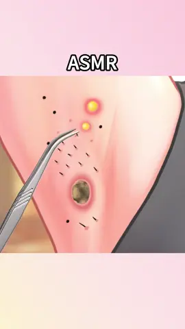 #asmr #asmrtreatment #relaxingasmr #satisfying #satisfyingvideo 