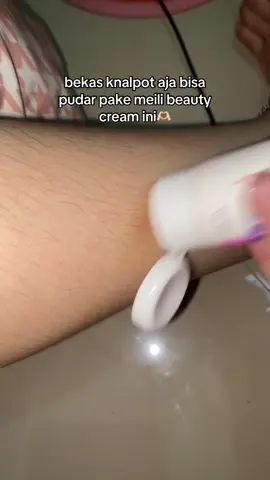 jadi gausa ragu buat cobain#promomakangajian #promoseruweekend #meilibeautycream #penghiilangbekasluka #bioherbal 